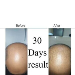 Neo Hair Lotion